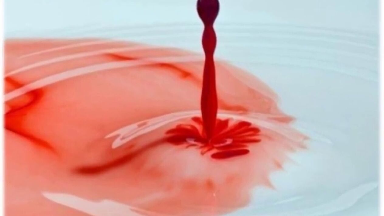 bloody discharge from penis