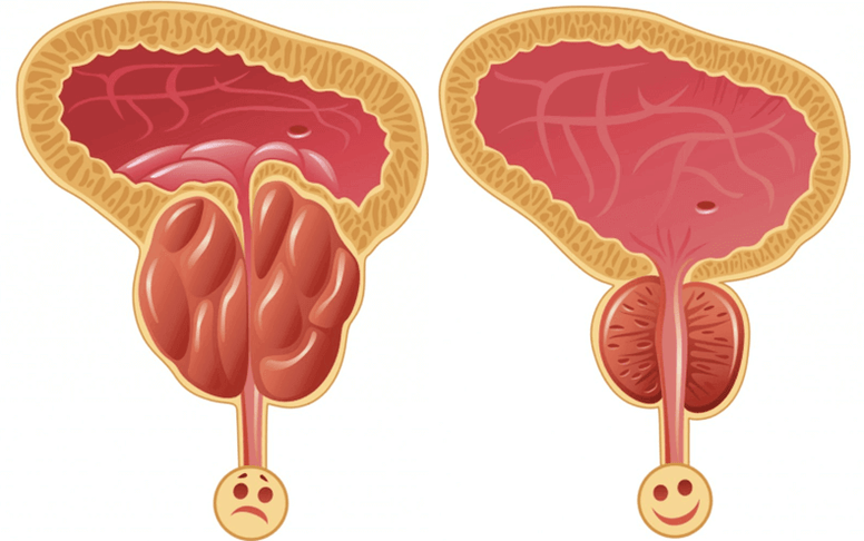 Causes of male sexual performance problems