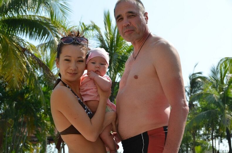 The harmful effects of age and overweight